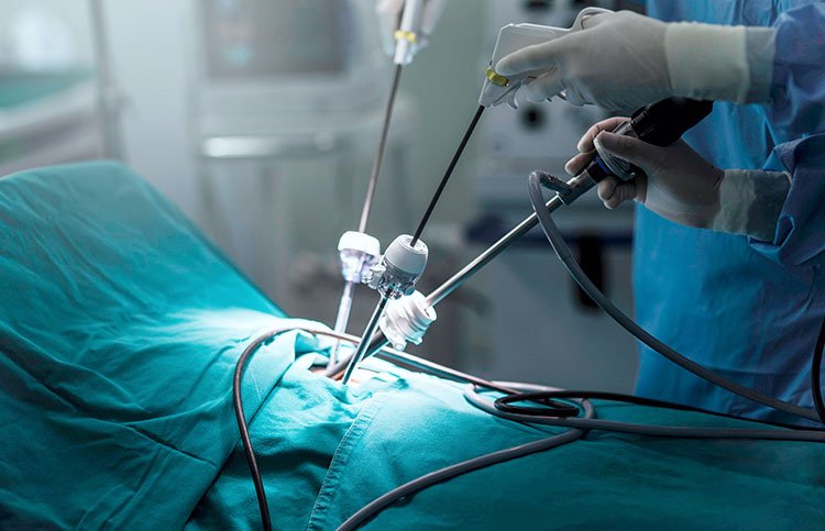 The-Panama-Clinic-Instituto-de-urologia-Laparoscopía